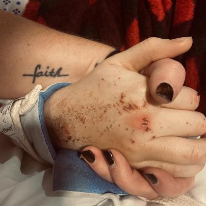 Kristen and Kara's hands - Photo courtesy of Kristen Dowell