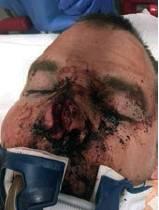 Humphrey immediately following his crash, photo courtesy of Devin Humphrey.