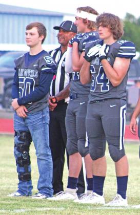 Devon Christian stands before a football game with a brace on his leg from his injury.