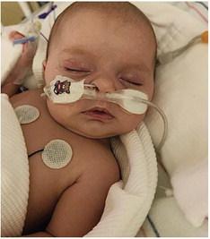 Keep your baby safe: One family’s harrowing experience with RSV